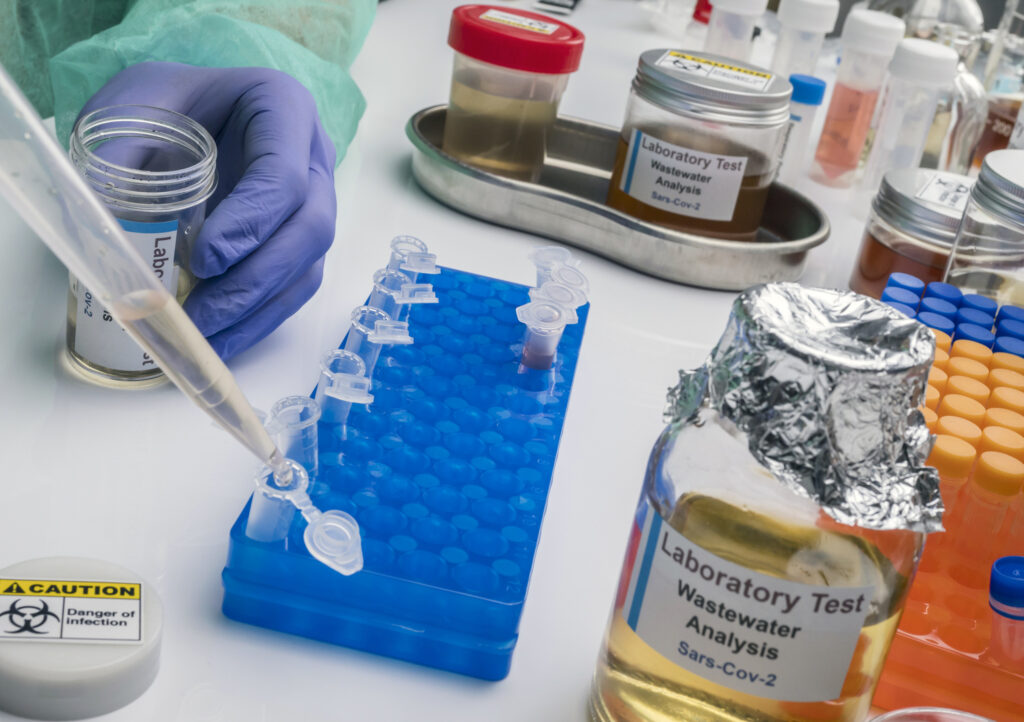 Scientific analysis of wastewater sample in laboratory, investigation of possible contamination by Sars Cov 2 in humans, conceptual image